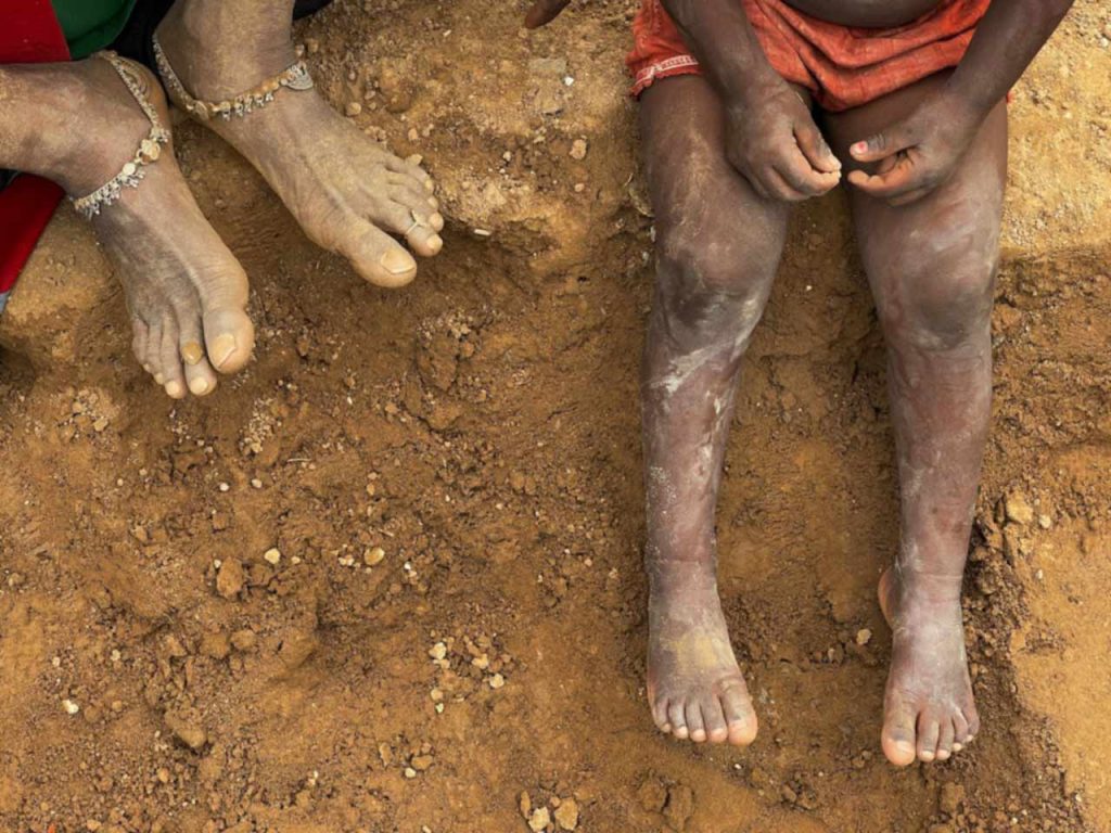 Two people sitting barefoot in the dirt. Photo: Nishant Aneja, Pexels